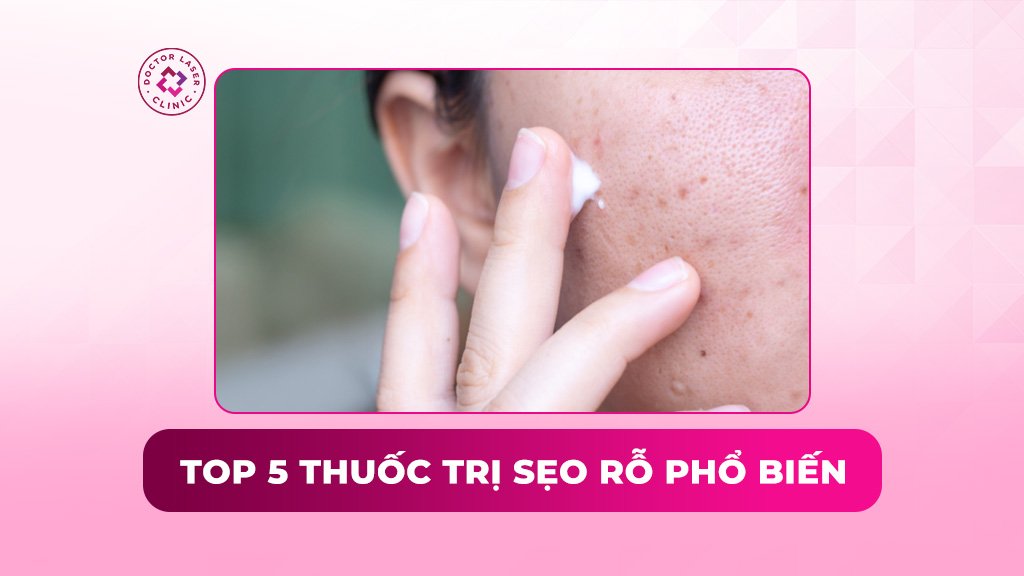 top 5 thuốc trị sẹo rỗ phổ biến