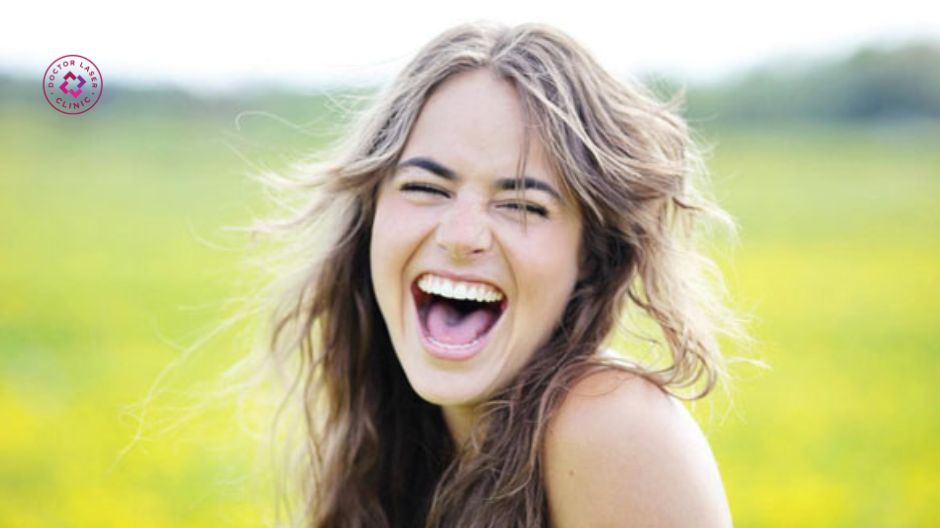 tránh cười lớn sau căng chỉ rãnh cười