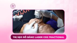 trị sẹo rỗ bằng laser co2 fractional