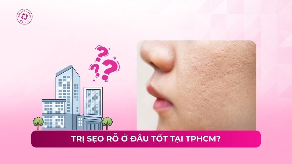 trị sẹo rỗ ở đâu tốt tại tphcm