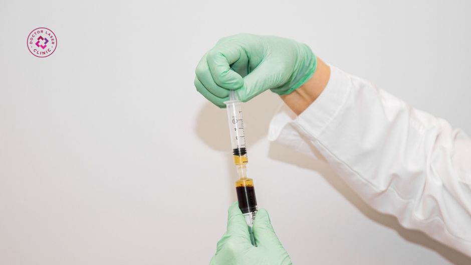 ứng dụng tiêm huyết tương giàu tiểu cầu trong thẩm mỹ