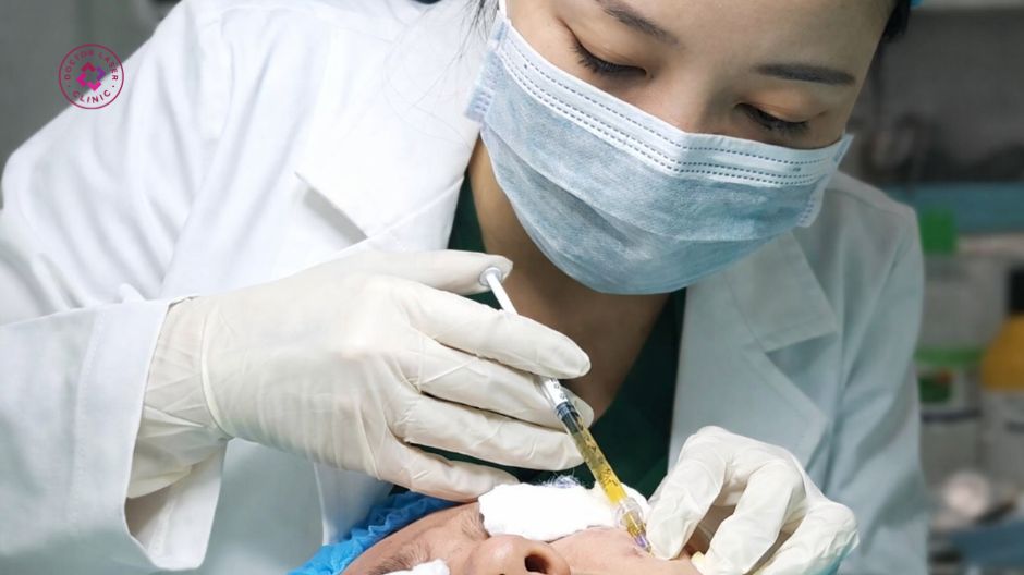 ưu điểm prp trị nám