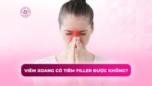 viêm xoang có tiêm filler được không