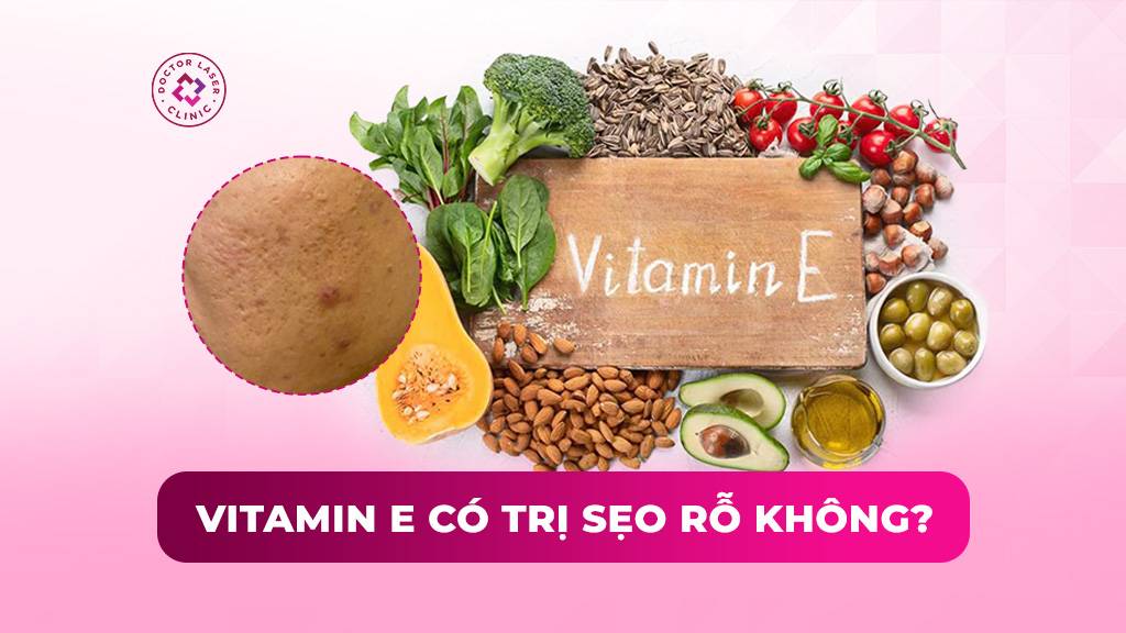 Vitamin E có trị sẹo rỗ không? Hiệu quả thật sự và cách dùng đúng