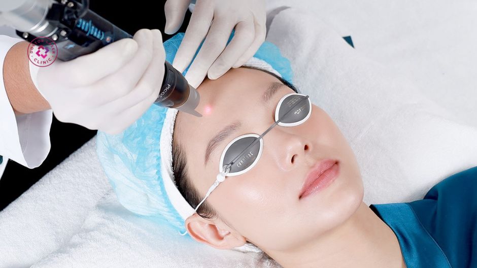 bác sĩ thực hiện laser pico