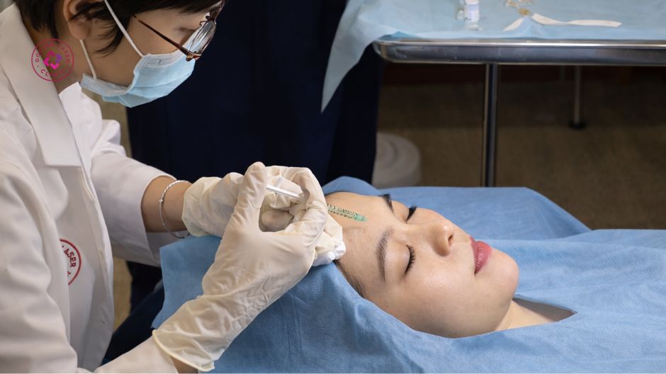 bác sĩ thực hiện tiêm botox xoá nhăn trán