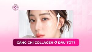 căng chỉ collagen ở đâu tốt