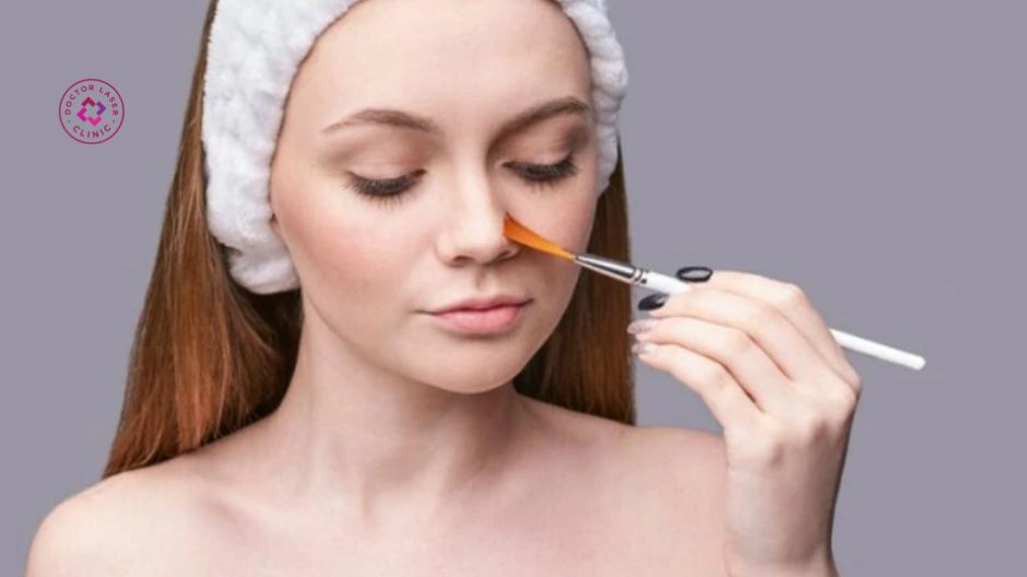 không peel da trước khi laser pico