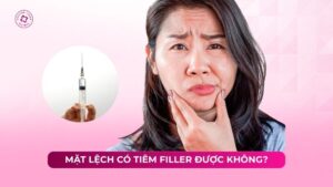 mặt lệch có tiêm filler được không