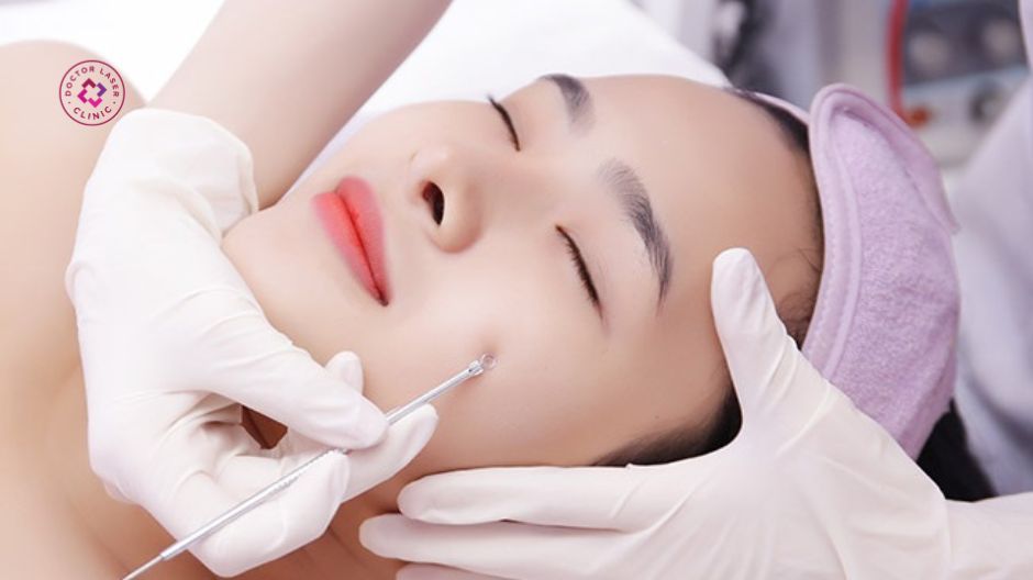 nặn mụn trong điều kiện vô trùng