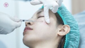 nếu tăng giảm cân sau tiêm filler mặt có thay đổi không nếu tăng giảm cân sau tiêm filler mặt có thay đổi không