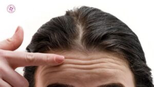 nếu tiêm botox nhiều năm liên tục, cơ mặt có bị yếu hoặc teo đi không nếu tiêm botox nhiều năm liên tục, cơ mặt có bị yếu hoặc teo đi không