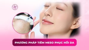 phương pháp tiêm meso phục hồi da