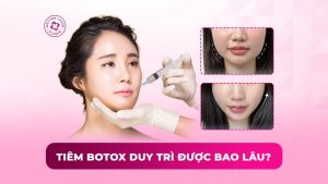 tiêm botox duy trì được bao lâu