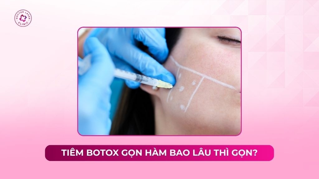 Tiêm botox gọn hàm bao lâu thì gọn? Các giai đoạn thay đổi cụ thể
