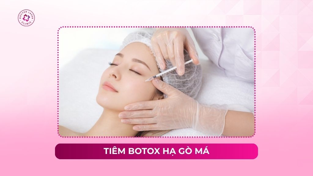 Tiêm botox hạ gò má: Hiệu quả thực tế và quy trình