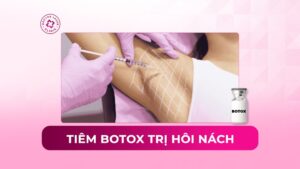 Tiêm botox trị hôi nách có hiệu quả không?