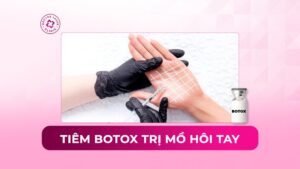 Tiêm botox trị mồ hôi tay có hiệu quả không?