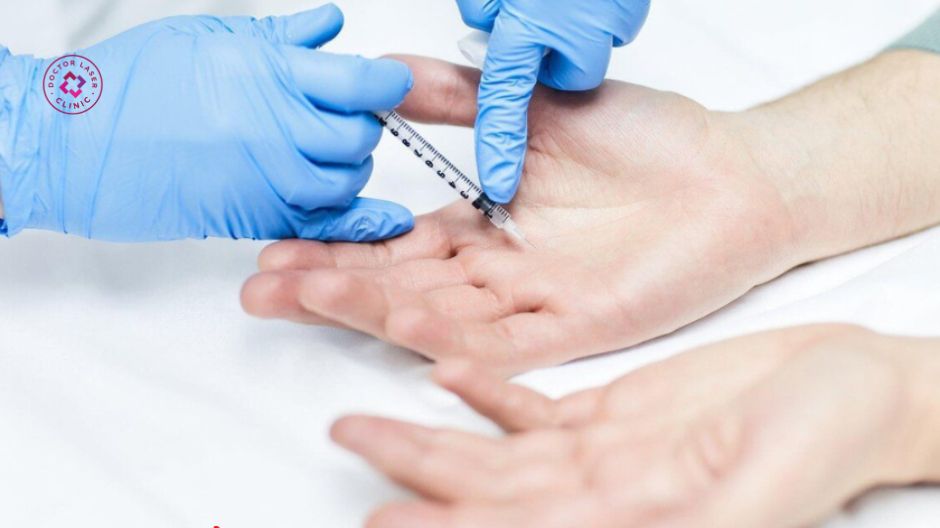 tiêm botox trị mồ hôi tay hiệu quả