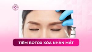Tiêm botox xóa nhăn mắt có nên không? Rủi ro và thời gian duy trì