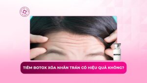 Tiêm botox xóa nhăn trán có hiệu quả không? Khi nào phù hợp?