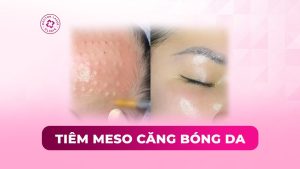 tiêm meso căng bóng da