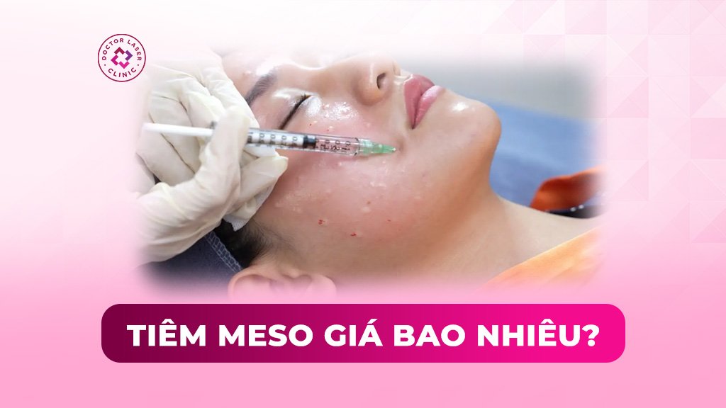 Tiêm meso giá bao nhiêu? Bảng giá chi tiết theo từng dịch vụ