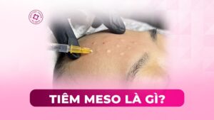 tiêm meso là gì