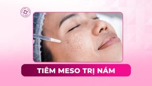 tiêm meso trị nám