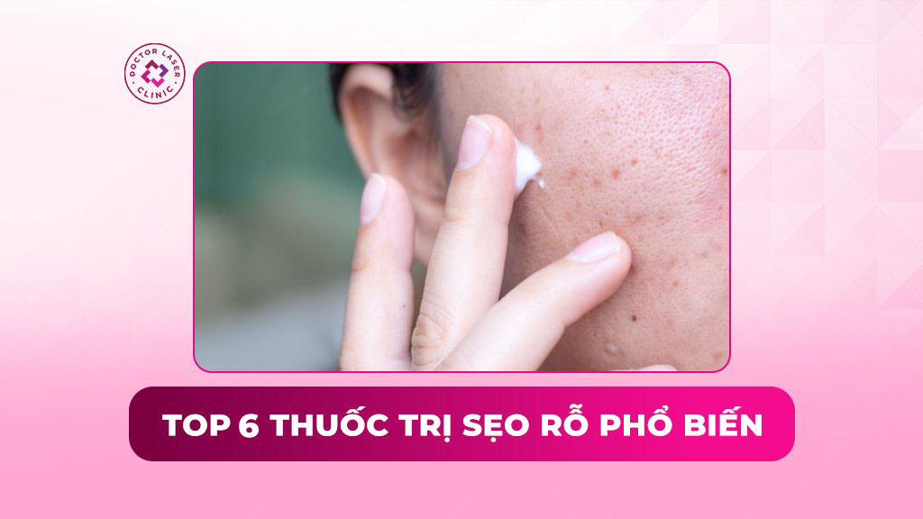 6 nhóm thuốc trị sẹo rỗ trên mặt được đánh giá cao hiện nay
