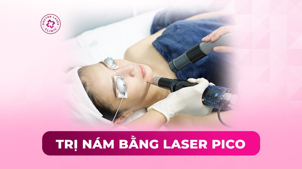 Điều trị nám bằng Laser Pico có hiệu quả không?