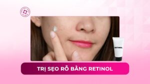 trị sẹo rỗ bằng retinol