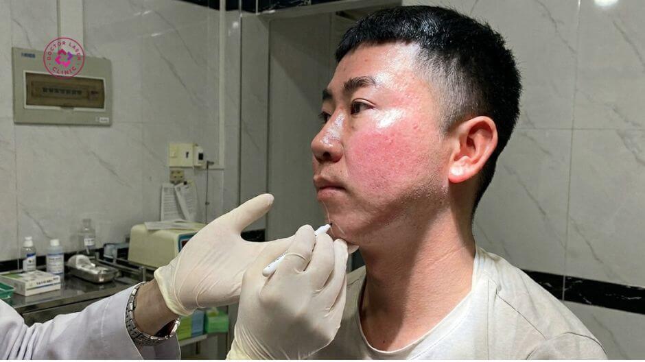 bác sĩ đánh giá cấu trúc cằm trước tiêm filler nam giới