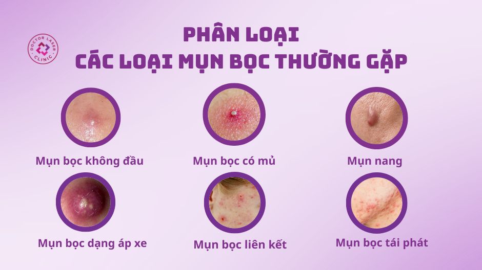 các dạng mụn bọc thường gặp