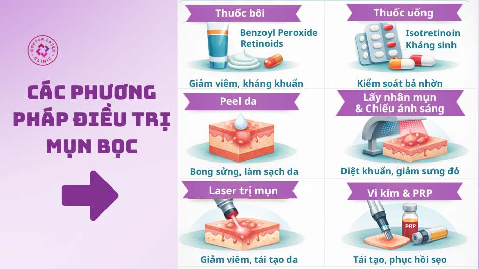 các phương pháp điều trị mụn bọc chuẩn y khoa