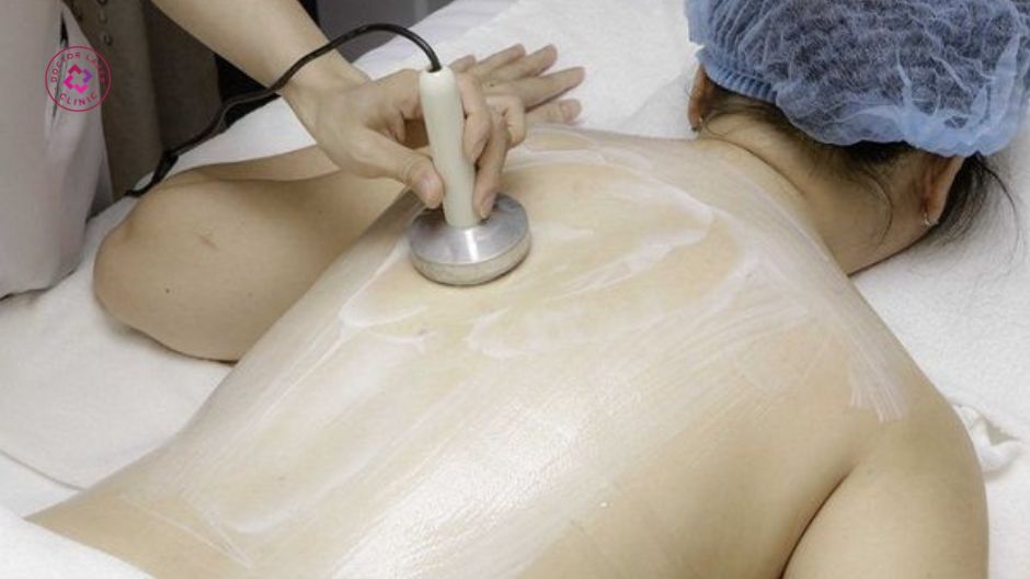 các yếu tố ảnh hưởng điều trị mụn lưng