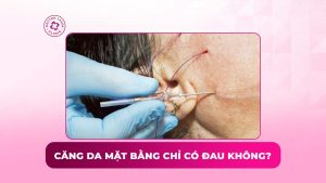 căng da mặt bằng chỉ có đau không