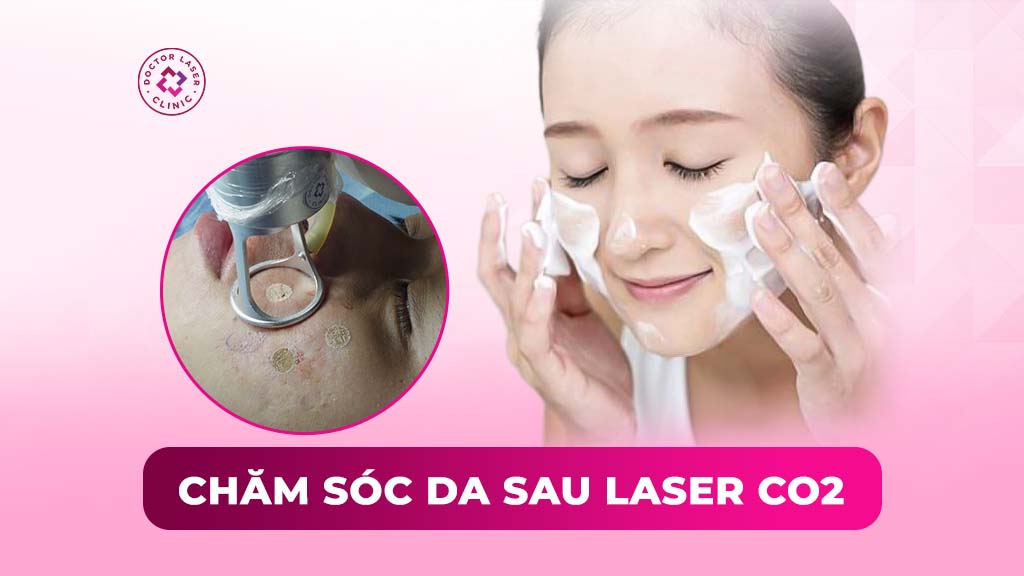 chăm sóc da sau laser co2