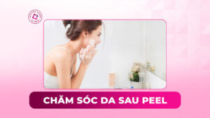 chăm sóc da sau peel