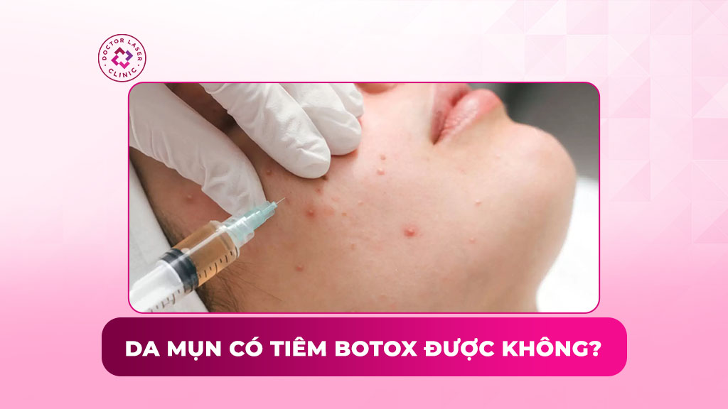 Da mụn có tiêm botox được không? Tác động và lưu ý khi tiêm