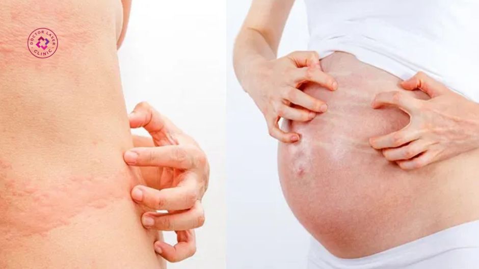 dị ứng da sau thủ thuật thẩm mỹ