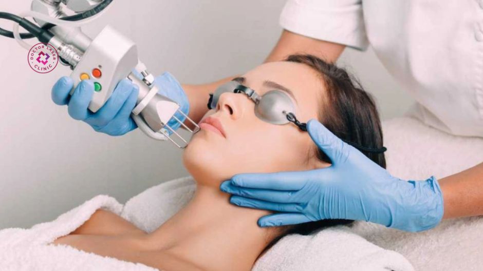điều trị u hạt sau tiêm meso bằng laser