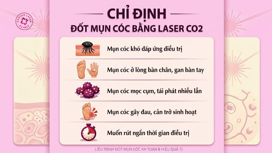 đối tượng chỉ định đốt mụn cóc bằng laser co2