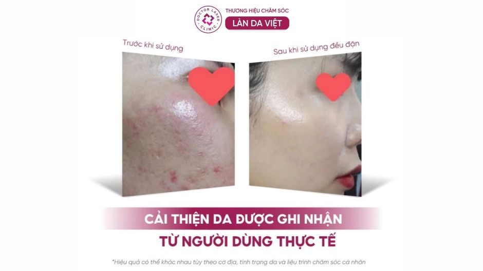 ghi nhận kết quả serum dưỡng ẩm dr clariv elixir blanc