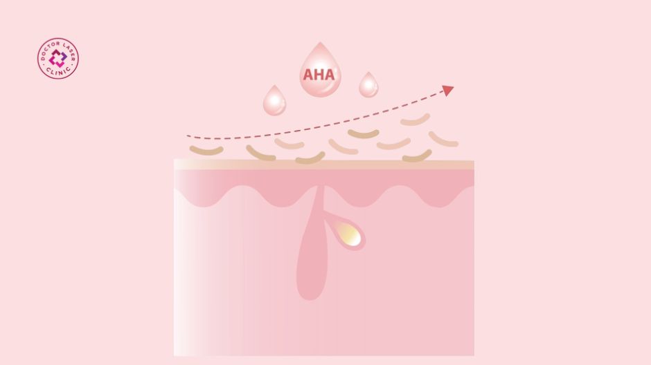 glycolic acid aha trị mụn lưng
