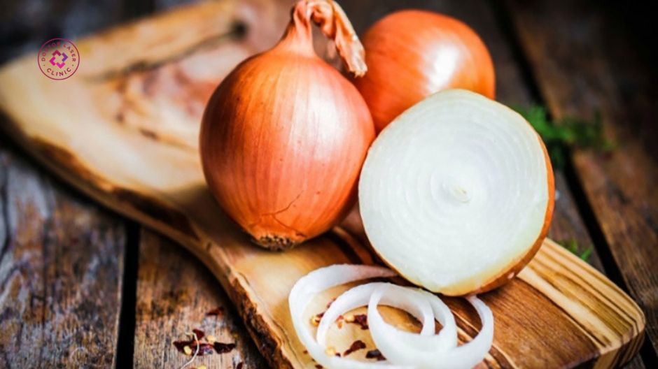 hành tây trị mụn lưng