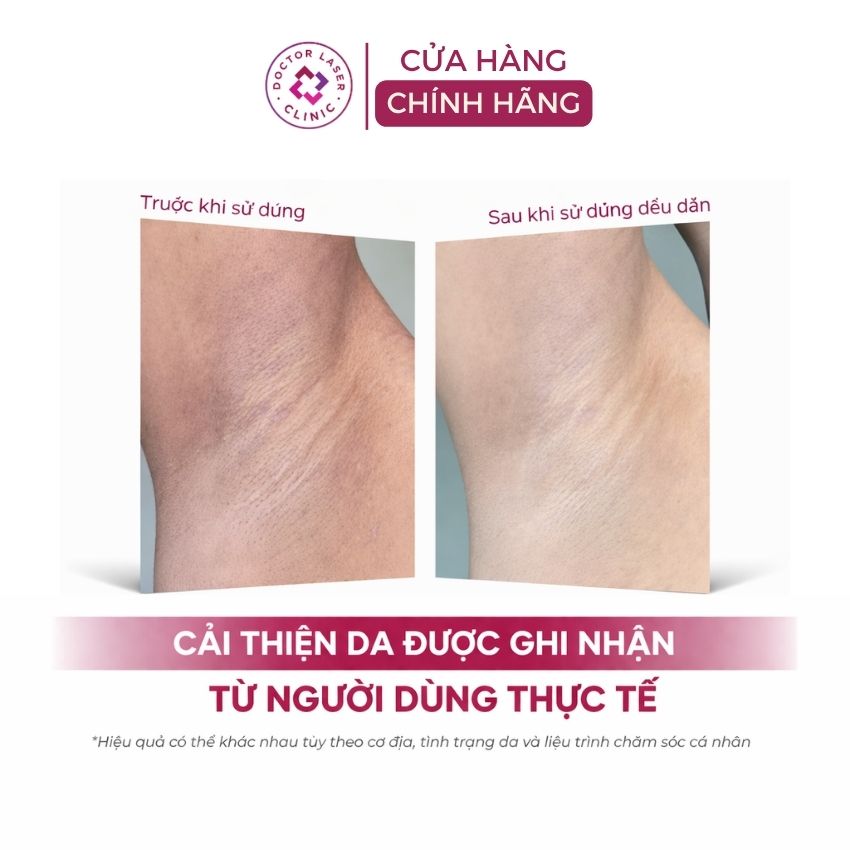 hiệu quả dùng muối tắm tẩy tế bào chết nách dr cosmess hiệu quả dùng muối tắm tẩy tế bào chết nách dr cosmess