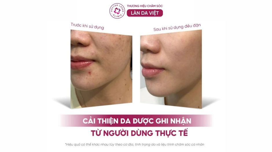 hiệu quả serum dưỡng ẩm dr clariv elixir blanc