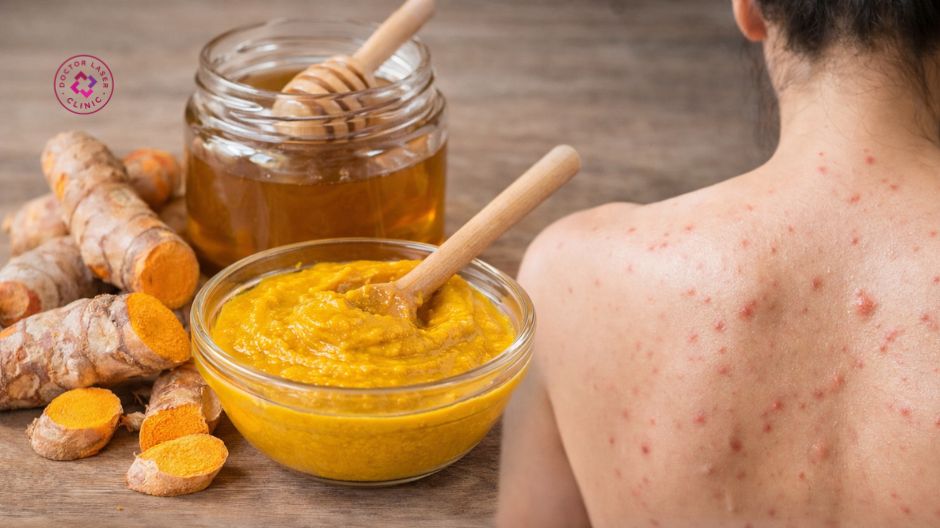 hỗn hợp nghệ tươi mật ong