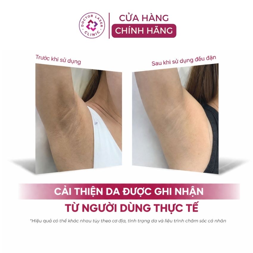 kết quả dùng muối tắm tẩy tế bào chết nách dr cosmess kết quả dùng muối tắm tẩy tế bào chết nách dr cosmess